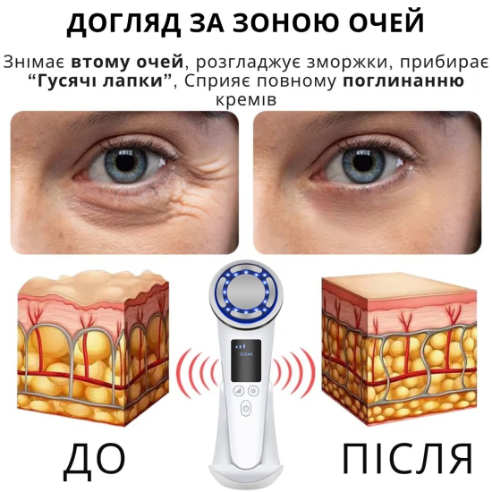 Мікрострумовий массажер для обличчя AIMED SkinLift Pro Anti-Aging з функцією RF Lifting, Hot&Cold компресом, EMS та LED світлотерапією колір білий