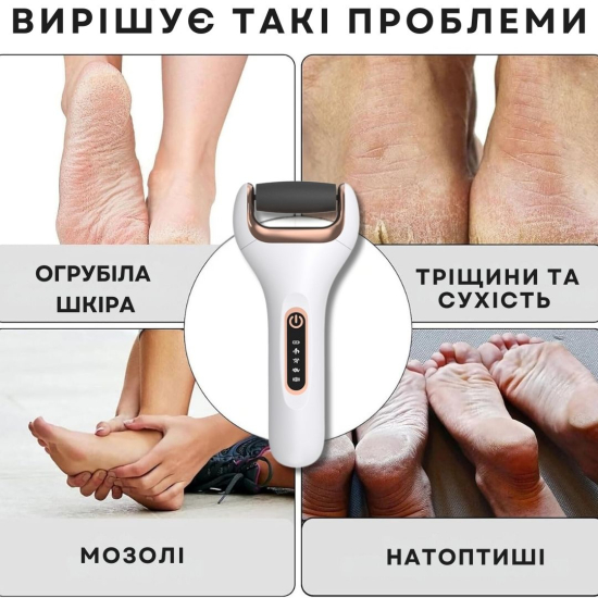 Електрична роликова пилка-пемза AIMED Foot Master Classic колір білий