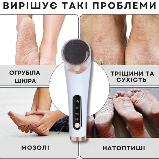 Електрична роликова пилка-пемза AIMED Foot Master Round колір білий