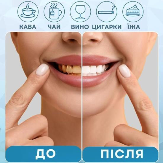 Гель для відбілювання зубів AIMED Smile Gel набір 3 шт