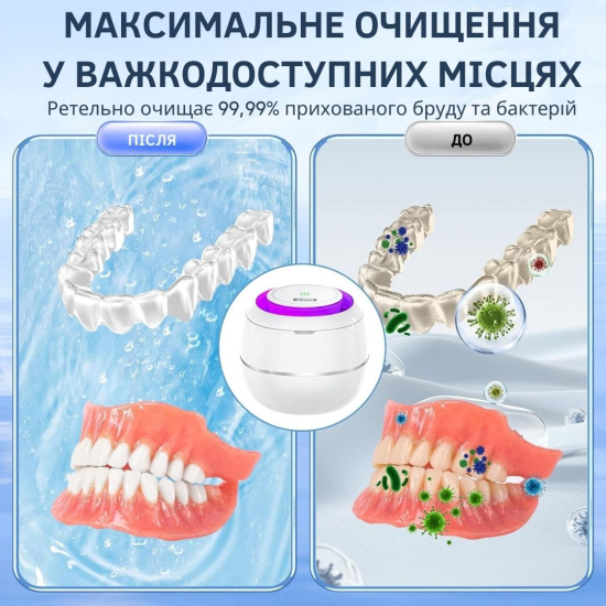 Ультразвуковий прилад для очищення зубних протезів AIMED Dental Master