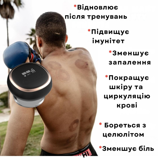 Баночний антицелюлітний масажер AIMED Guasha Master колір чорний
