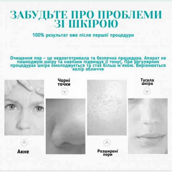 Вакуумний очищувач пор AIMED PORE CLEANER MINI